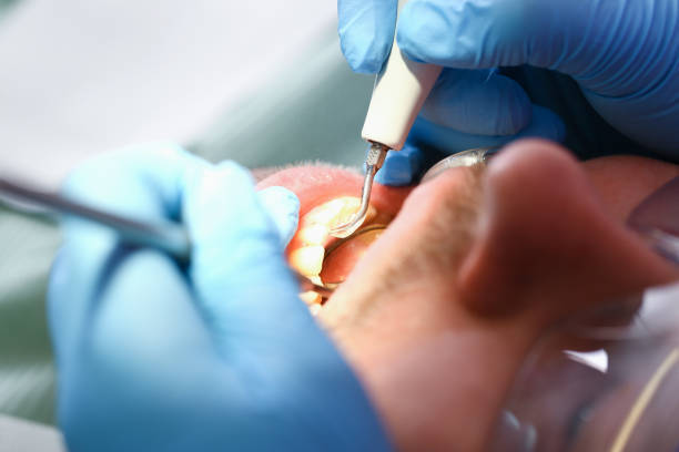 Best Emergency Dental Services for Seniors in Hartwell, GA